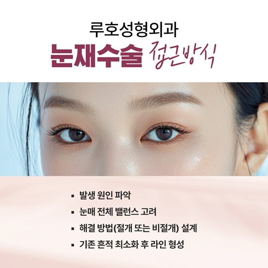 눈성형2_국문.jpg