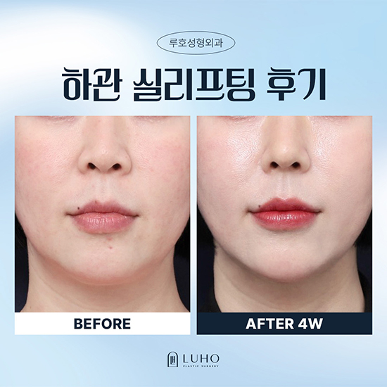 실리프팅1_국문 복사.jpg
