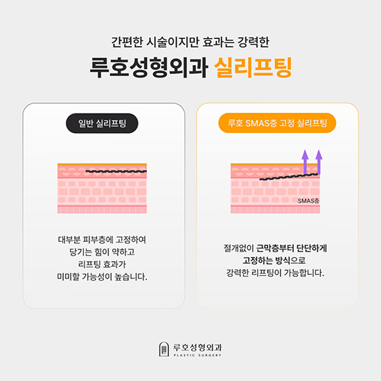 실리프팅2_국문 복사.jpg