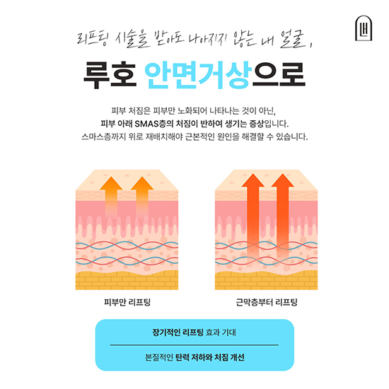 안면거상2_국문 복사.jpg