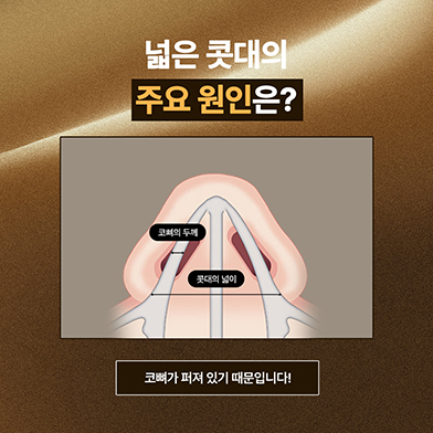 코수술2_국문 복사.jpg