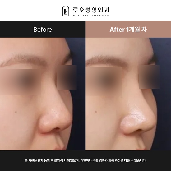 복코재수술_국문.jpg