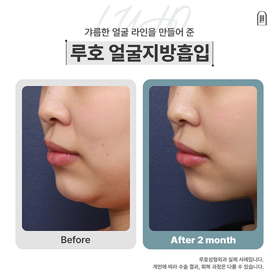 얼지흡1_국문 복사.jpg