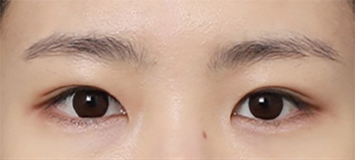 후_24일.jpg