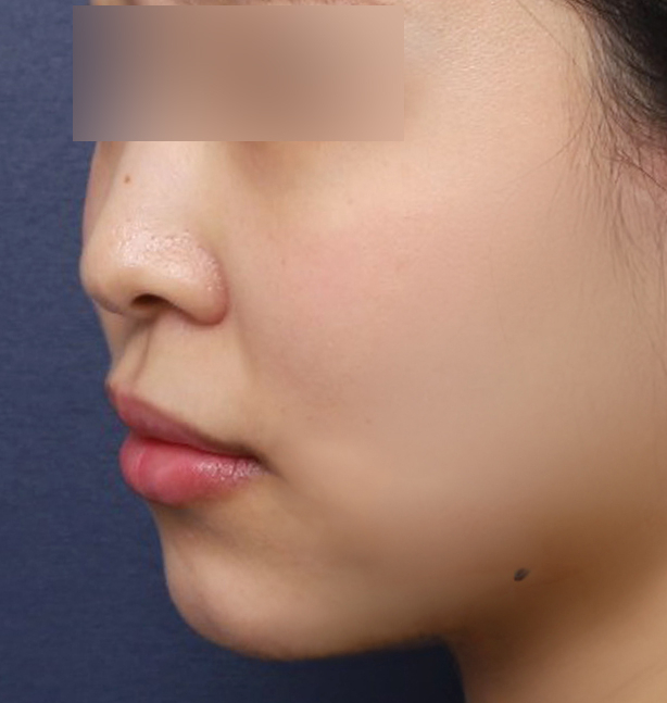 SE-4fc0c49a-d8b0-4078-baf9-58ab9dce48b3.jpg