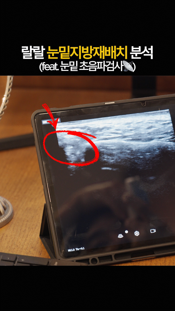 260225_랄랄눈밑지_04_eddy_10.gif