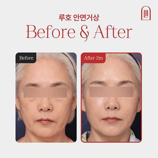 1 복사.jpg