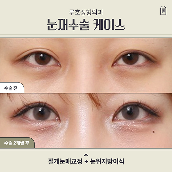 눈재1_국문 복사.jpg