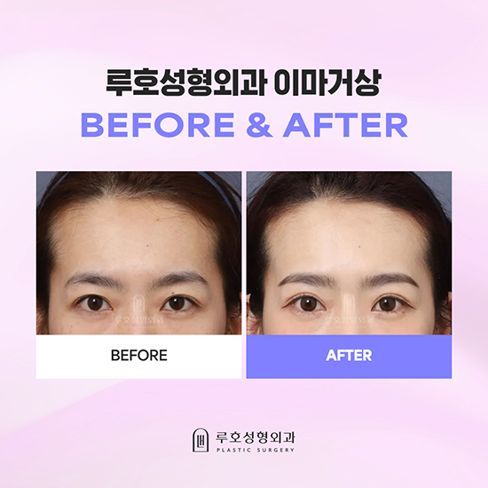 이마거상1_국문 복사.jpg