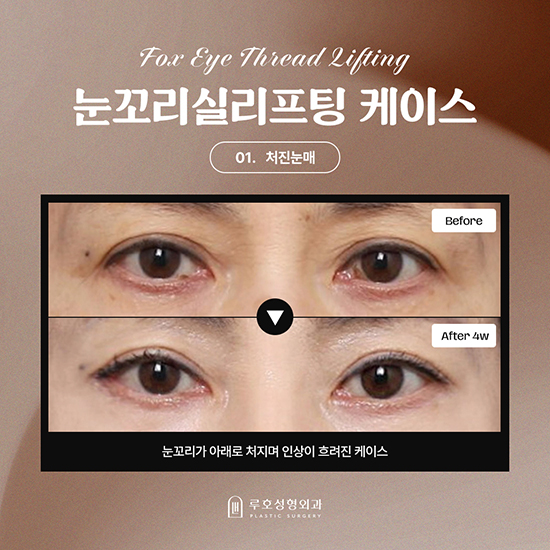 1_국문 복사.jpg