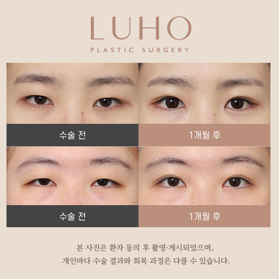 전후_메인_대표.jpg
